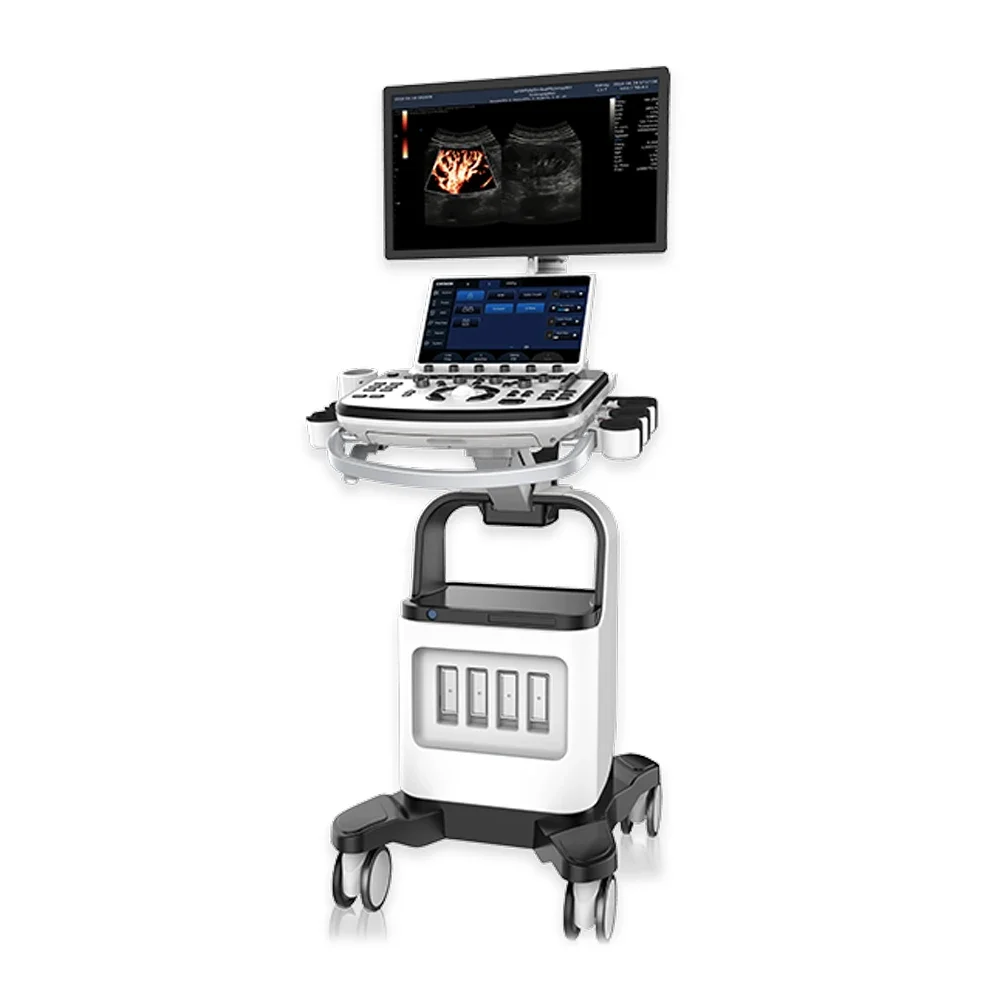 Рисунок 3 - Ультразвуковой сканер на колесиках с ЖК-дисплеем 23