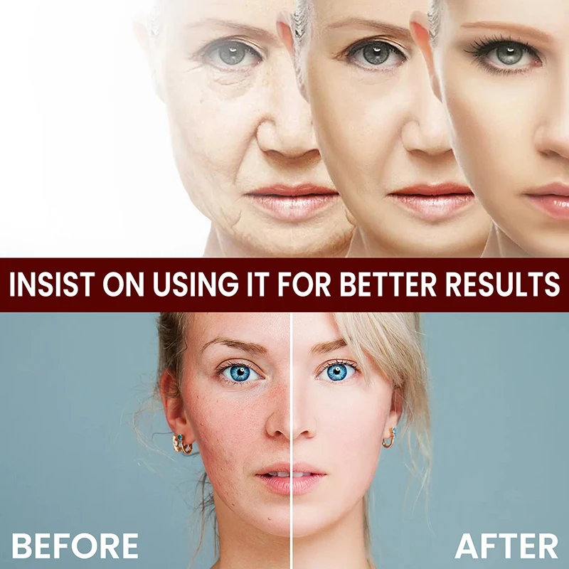 White Rice Whitening Cream Opstrammende Anti-Rynke Blur Fin Line Fjernelse Rynker Forstærk kedelig fugtgivende ansigtspleje splinterny_voghion.com
