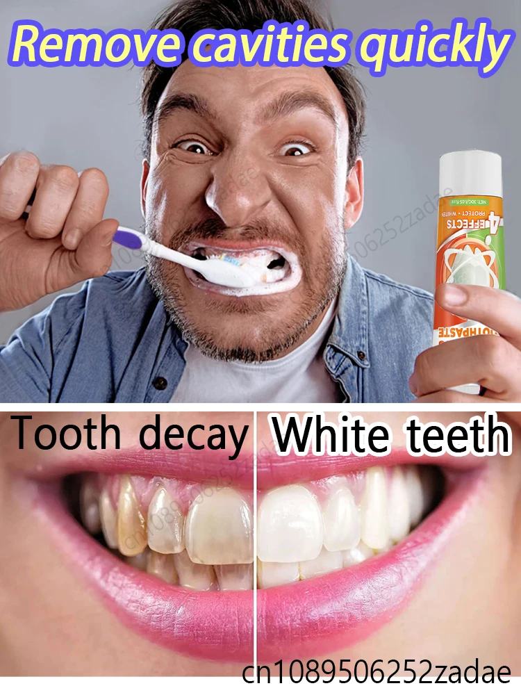Probiotic Toothpaste Solves Tooth Gum Pain Prevents Dental Problems Whitens Teeth