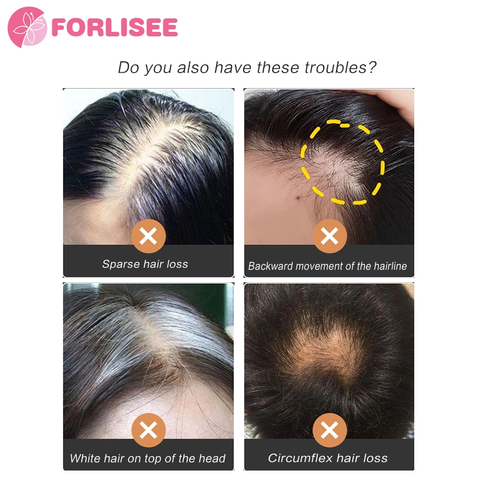 FORLISEE ռ   ž,   ,   ž, ǫ õ  ü 