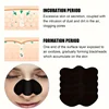 10/50/100 Pieces Facial Blackhead Removal Stickers - Effective Pore And Nose Cleansing Stickers, Gentle Deep Cleansing Care Stic 2