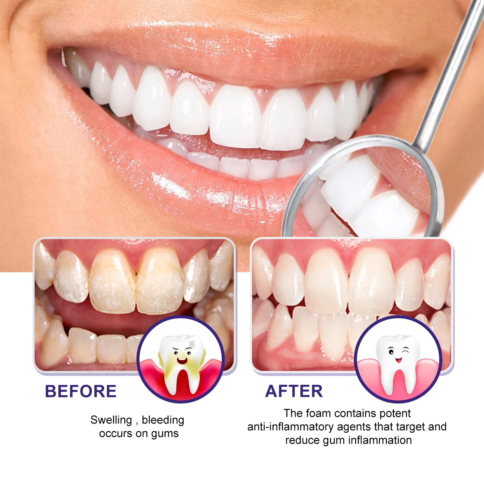 Tooth Whitening Foam Mousse Prevent Periodontitis Toothache Relief Dental Calculus Stain Removal Repair Gums Decay Oral Hygiene