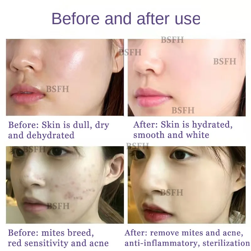 Japanese Magic Oxygen Bubble Machine Special Liquid for Whole Body Whitening Rejuvenating Skin Cleaning Mite Removing Essence 4
