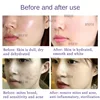 Japanese Magic Oxygen Bubble Machine Special Liquid for Whole Body Whitening Rejuvenating Skin Cleaning Mite Removing Essence 4