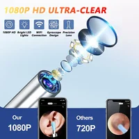 Nettoyeur visuel de cire d'oreille avec caméra, Endoscope d'élimination du cérumen en toute sécurité avec caméra de 5M, Otoscope lumineux, outils de nettoyage des oreilles, soins des oreilles 3