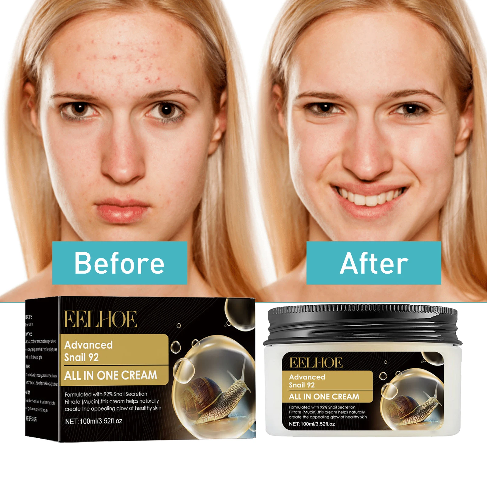 

Snail Face Cream Effective Acne Removal Shrinking Pores Fade Acne Repair Sensitive Skin Replenishing Moisturizer Smooth skin
