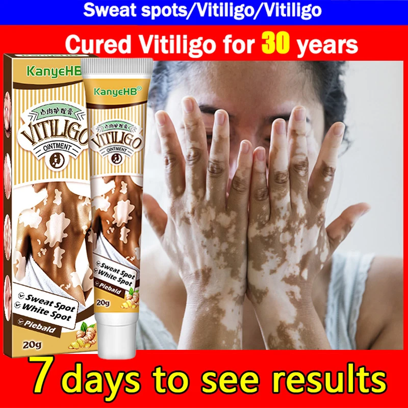 

New Remove Vitiligo Ointment Effectively Treatment Ringworm White Spot Removal Skin Vitiligo Eliminate Vitiligo Cream Body Care