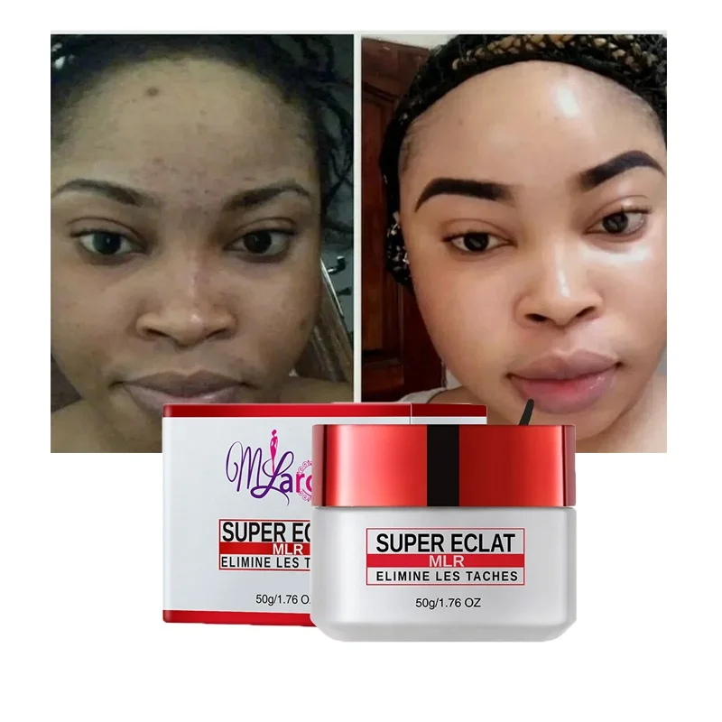 Extra Strong 7days Whitening Face Cream Fast Action Whitening Face Cream Super Effective Improve