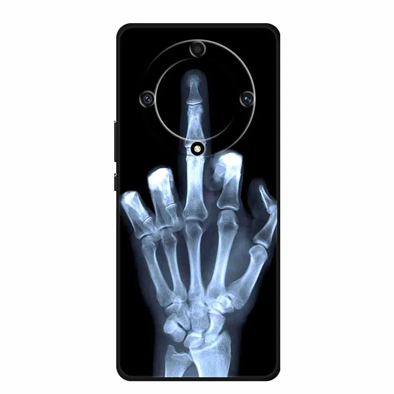 Shockproof Soft TPU Silicone Back Cover for Huawei Honor X9A - Durable Protective Phone Case