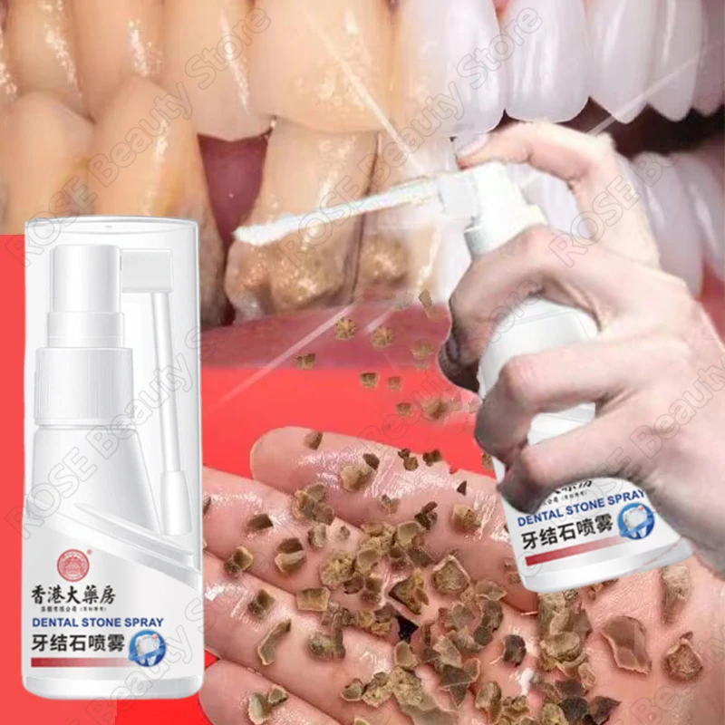 Dental Calculus Remover Teeth Whitening Spray Toothpaste Cleaning Oral Hygiene Removal Halitosis Plaque Stains Fresh Breath Care dental calculus remover