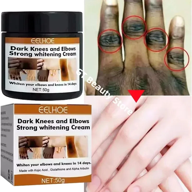 Dark Knuckles Fast Brighten Cream Elbows Hand Knuckle Brightening Serum Knee Black Skin Quickly Lighten Stains Remover Products