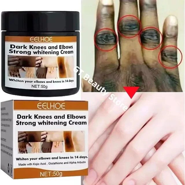 Nocche scure Crema schiarente veloce Gomiti Siero schiarente per nocche a mano Ginocchio Pelle nera Schiarire rapidamente i prodotti per la rimozione delle macchie 1