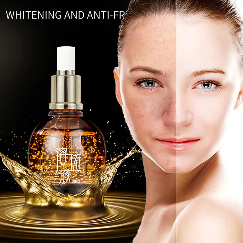 OSUFI Whitening Serum Remove Freckle Dark Spots Melasma Face Serum Melanin Improve Dull Essence Beauty Skin Care Products 50ml