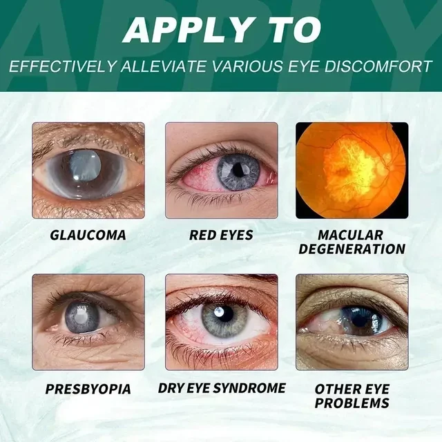 Eye Drops Relieves Eyes Discomfort Blurred Eyes Sore Eye Care Itchy Relax Dry Swelling Massage Clean 4