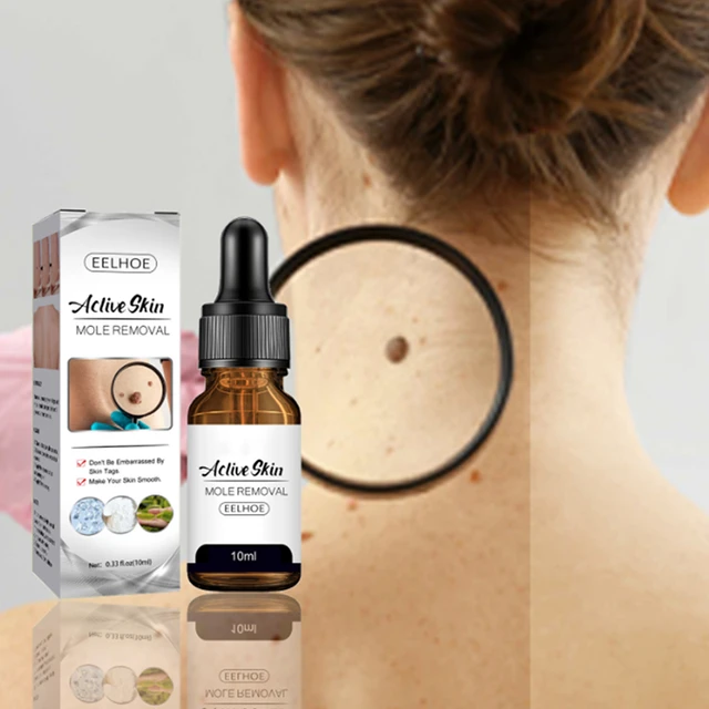 Mole & Skin Tag Removal Solution Painless Mole Skin Dark Spot Removal Face Liquid Wart Tag Freckle Removal Cream Oil Plaste - AliExpress