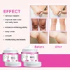 Advanced Skin Brightening Cream – Fade Dark Spots on Intimate Areas, Knees, Elbows & Knuckles Fast