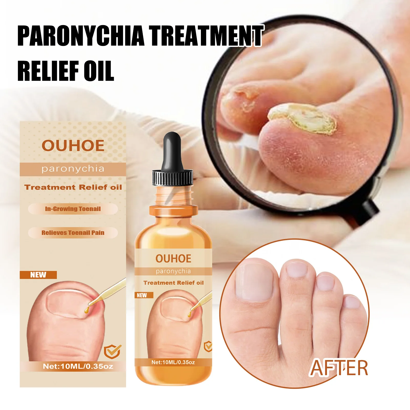 

Nail Strengthener Nail Renewal Nighttime Nail Essence 10ml Restores Appearance Of Discolored Or Damaged Nails Nail Renew Care