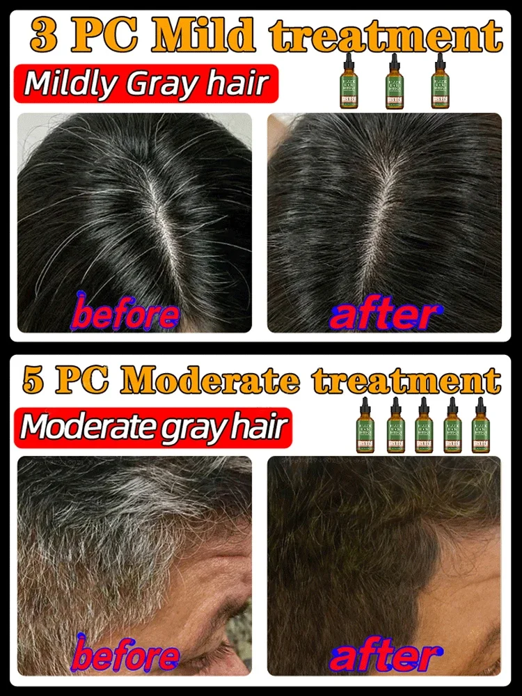 Ƽ ׷     , ȭƮ , 30ml