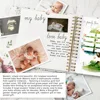 Bview Art 100 sheets Baby Growth Memory Book Set - Pregnancy to Toddler Journal with DIY Scrapbook Pages for New Parents 5