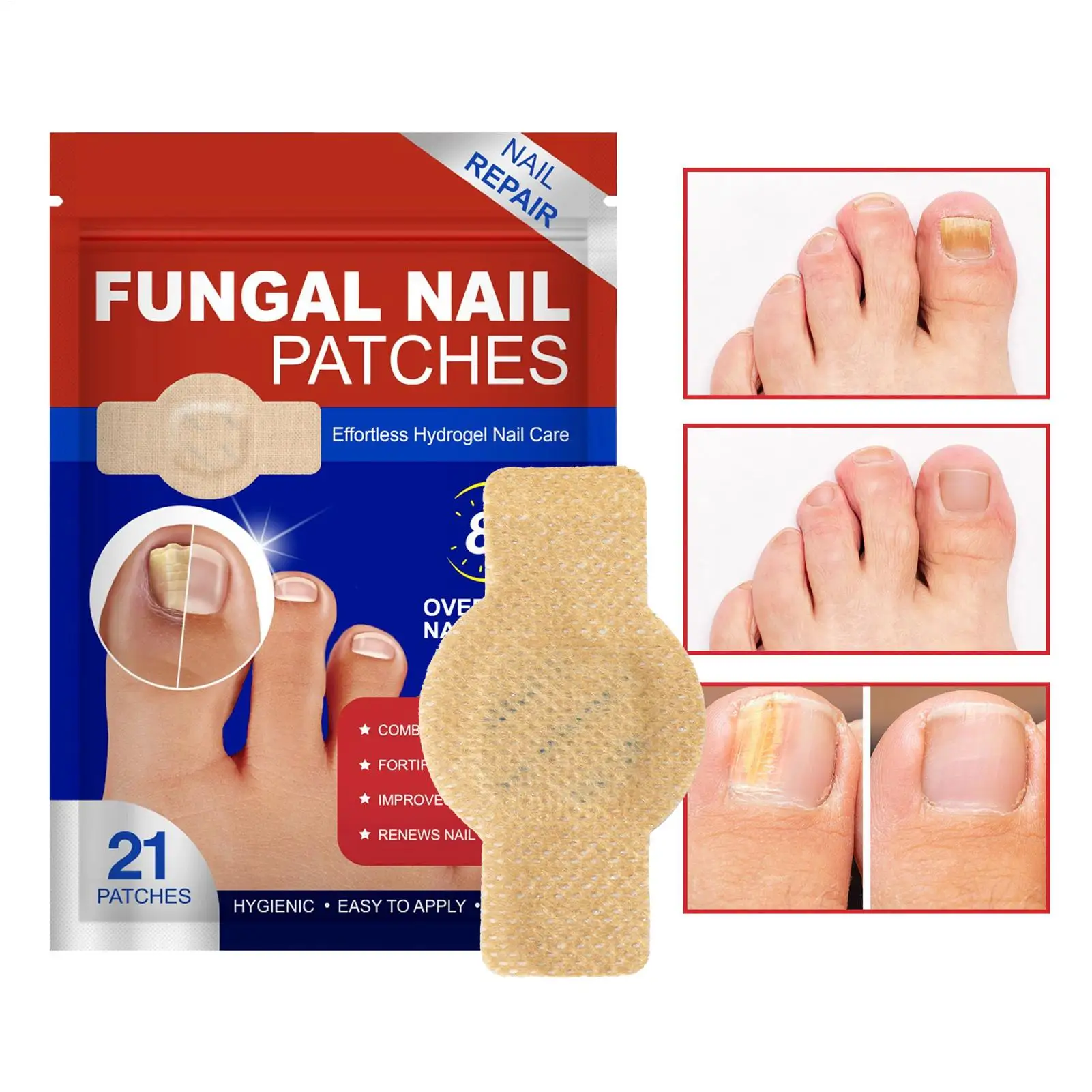 21Patches/bag Toenail Fungus Patch Waterproof Nail Repair Patches Nail Ingrown Correction Stickers For Fungal Nail Patches