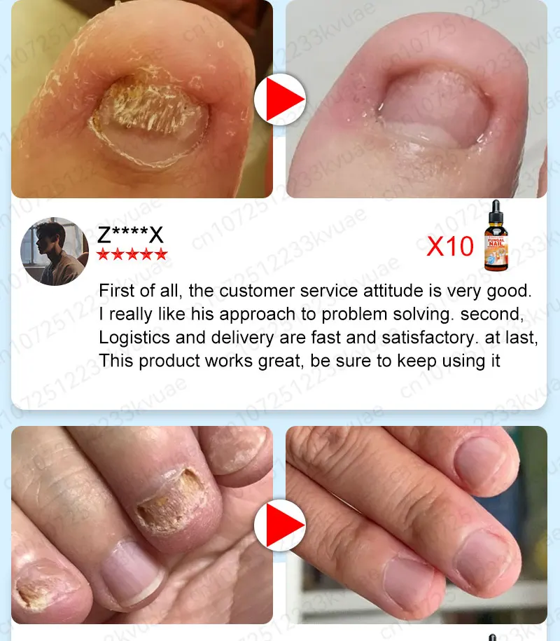 Description Picture 6 of itemnail