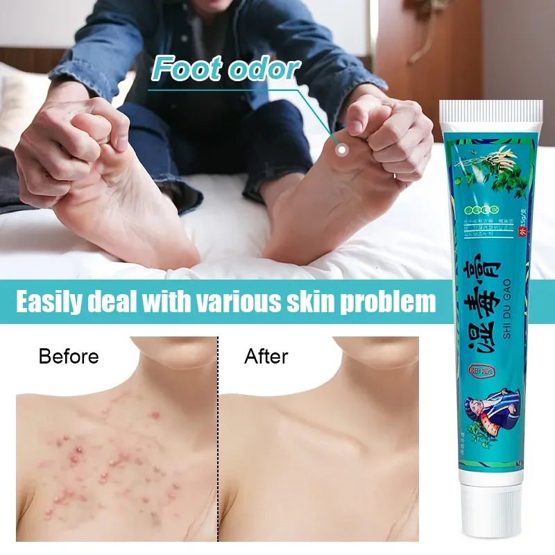 1Pcs Psoriasis Cream Skin Care Herbal Plaster Dermatitis Eczematoid Eczema Urticaria Treatment Ointment Relieve Skin Itch S068