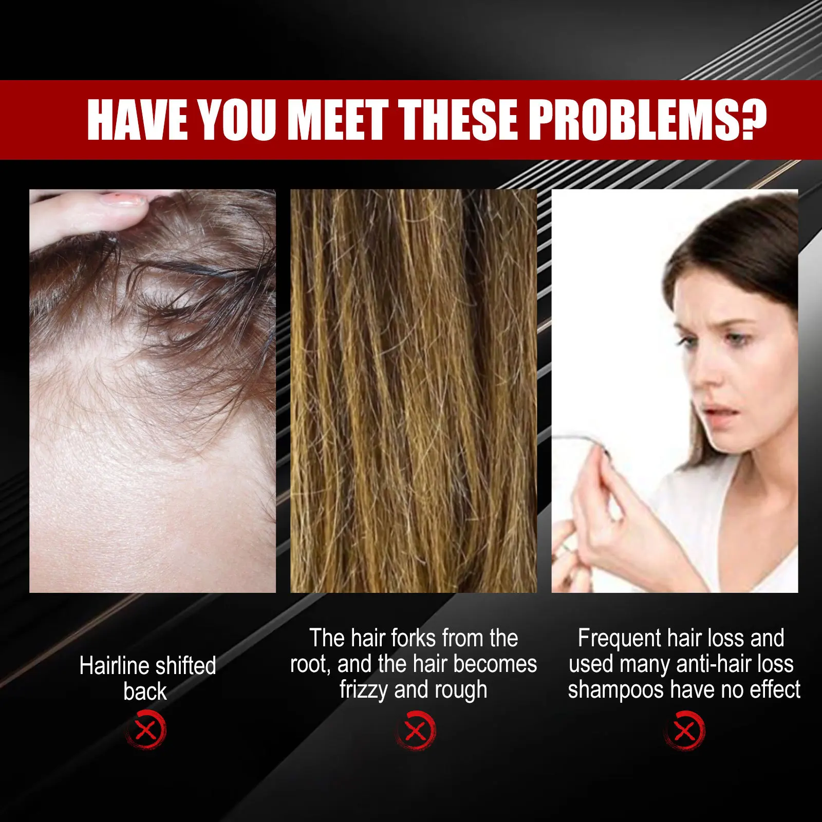 Black Rice Hair Growth Spray Frizzy Hair Treatment Smoothing Nourish Scalp Follicles Baldness Repair Damage Regrowth Spray
