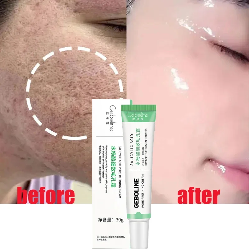 Salicylic Acid Pore Shrinking Cream Quick Elimination Large Pores Remove Blackehead Tighten Face Smooth Skin Korean Care Product slimming cream cellulite elimination body shaping fat burning sweating fat firming quick waist slimming sexy figure body care