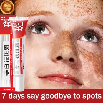 Effective Whitening Freckles Face Cream Remove Melasma Dark Spots Fade Melanin Acne Scars Anti-aging Brighten Repair Skin Care - Thumbnail 5