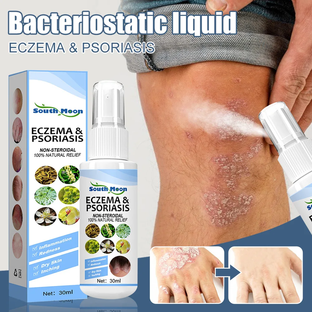 30ml Skin Psoriasis Spray Natural Herb Eczema Treatment Spray Itch Relief Improve Redness Dermatitis Psoriasis Health Care