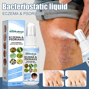 30ml Skin Psoriasis Spray Natural Herb Eczema Treatment Spray Itch Relief Improve Redness Dermatitis Psoriasis Spray Health Care