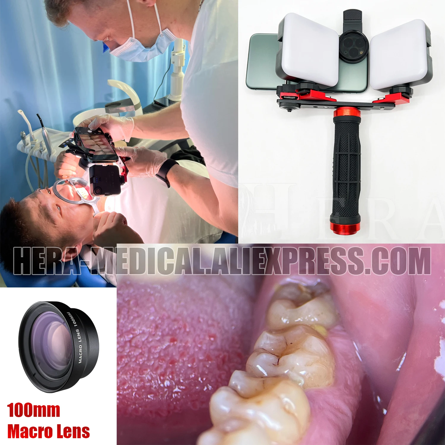 MK 16 Bluetooth Dental Flash Light Photography Equipment Dentistry LED Oral Filling Light for Dentist Lighting Dental Fill light images - 6