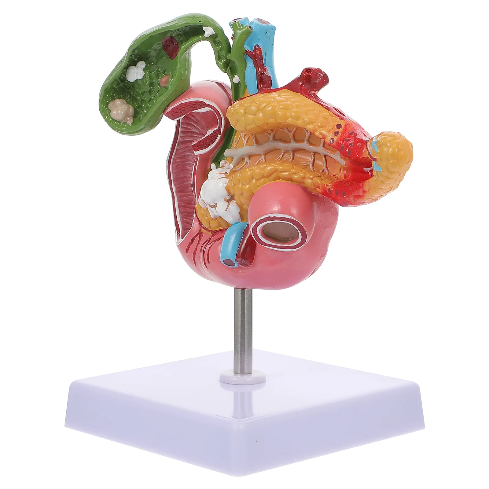 

Патологическая модель желчного пузыря, анатомия, учебные инструменты, дуоденальный человеческий дуоденовый желчный камень, пищеварительная система ПВХ, поджелудочная железа