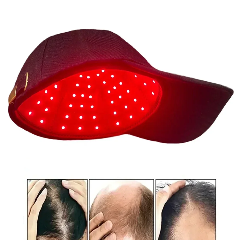 RedLightInfrared660nm850nmHairTherapyHairGrowthCapforHairRegrowthAntiHairLoss.png