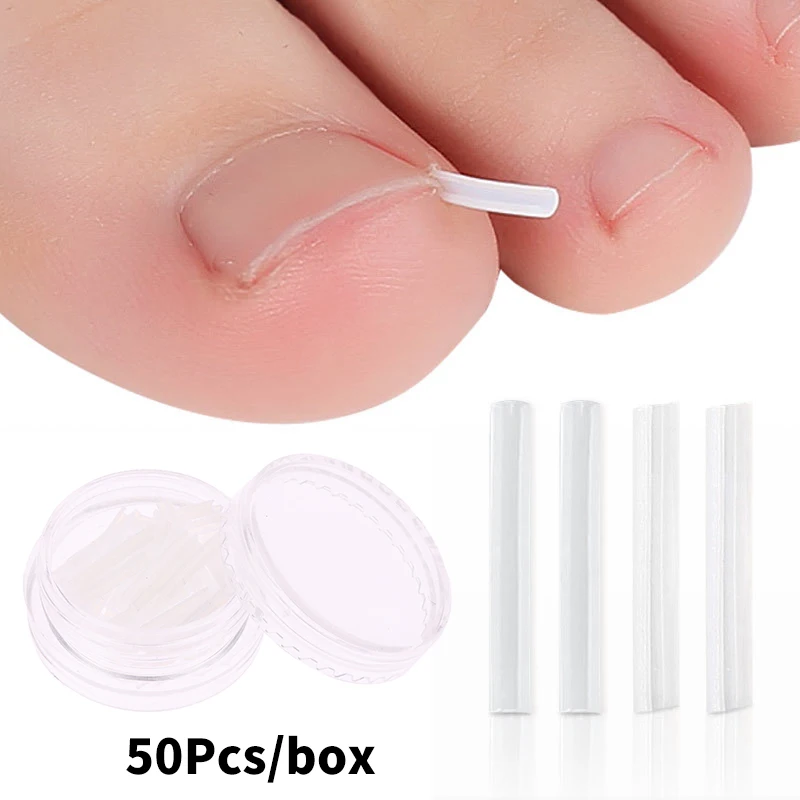 50Pcs Ingrown Toenail Correction Tool Ingrown Toe Nail Treatment Elastic Patch Sticker Straightening Clip Brace Pedicure Tool