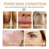 Face Whitening Serum Turmeric Dark Spot Correcting Essential Oil Brighten Fade Freckle Removal Pigment Beauty Face Skin Care 5