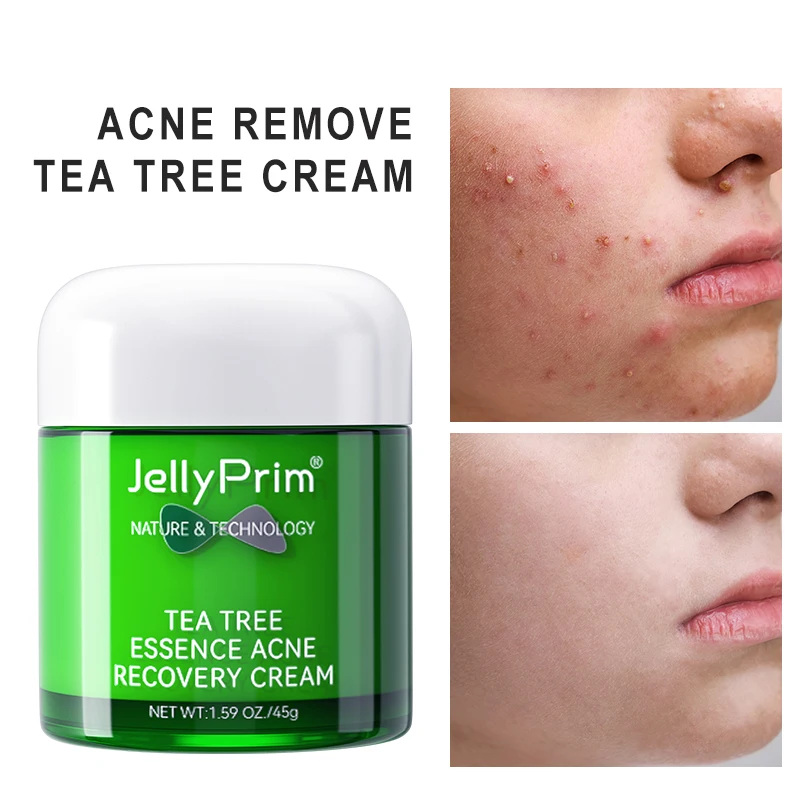 Pockmark Crema Viso Tea Tree Vitamina E Crema Viso Idratante Per Il Controllo Dell'Olio Giorno E Notte Cura Della Pelle Donna Uomo 45G