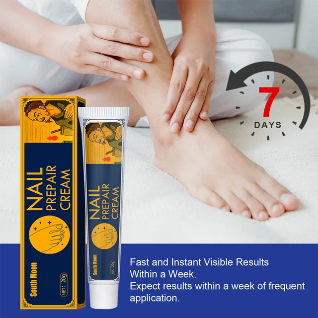Effective Foot Treatment Cream Anti Fungal Infection Onychomycosis