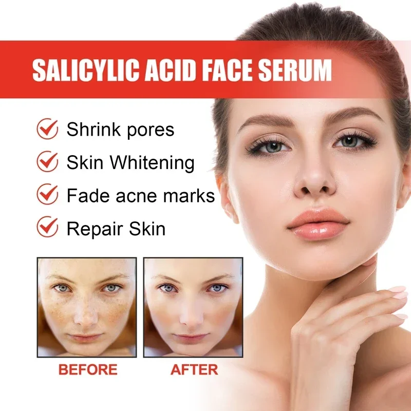 Niacinamide Facial Serum Salicylic Acid Moisturizing Skin Care Products 2024 5