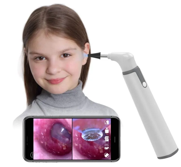 

3.9mm wifi visual digital otoscope ear endoscope camera ear wax cleaner camera for ears nose dental support ios androids