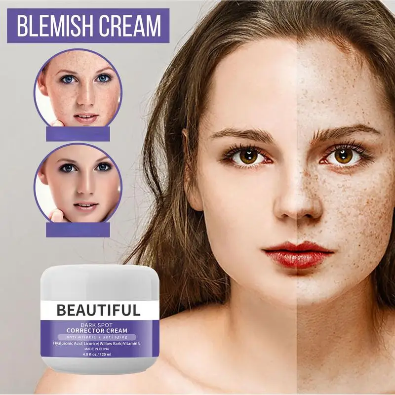 

Moisturizing, moisturizing and freckle removing skin care cream