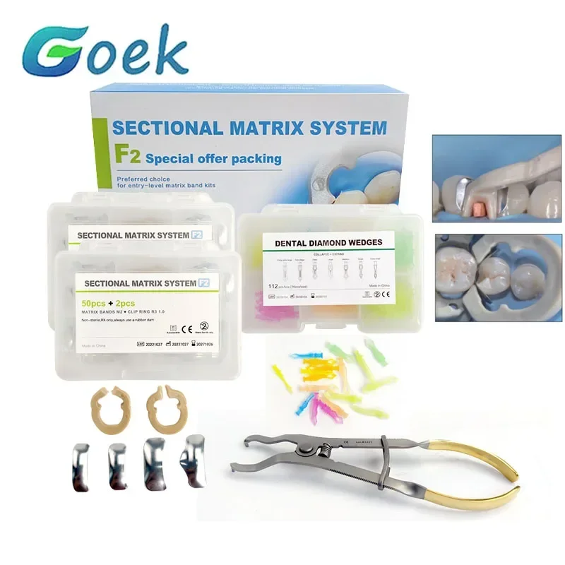 153 teile/schachtel Dental Wirtschaftliche Schnitt Kits F2 5 Größen Diamant Keile + Kraftstoffe Peek Clamp Kieferorthopädie Zahnmedizin Materialien Werkzeug