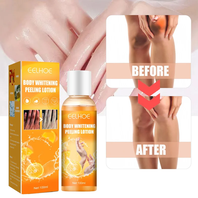 

immediate Whitening Cream Peel Peeling Gel Skin Peeling Mask Fnger Knee Armpit Dark Spots Body Brighten Clean Skin Care 100ml