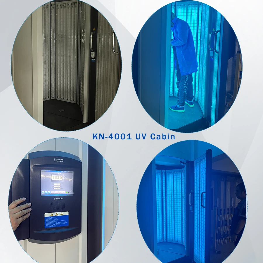 Рисунок 3 - Зернистость, УФ-кабина 311нм