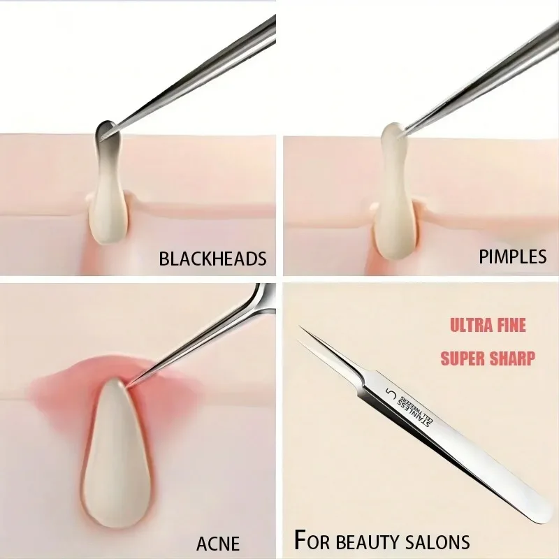 German Ultra-fine No. 5 Cell Pimples Blackhead Clip Tweezers Beauty Salon Special Scraping & Closing Artifact Acne Needle Tools