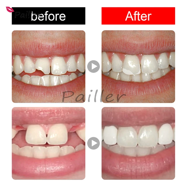 Temporary Tooth Repair Beads Missing Broken Teeth Dental Tooth Filling  Material Food Grade FalseTeeth Solid Glue