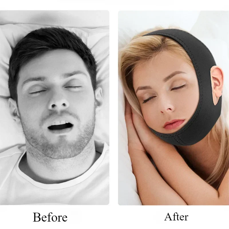 Adjustable Anti Snore Belt for Snoring Relief Breathable Chin Strap Night Sleeping Aid Jaw Support Men Women Snoring Protection