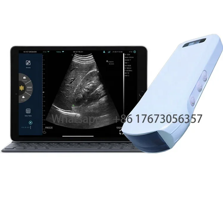 Ecografo Ginecologico Ecografo Wifi 3D Ecografo 4D Color Doppler Ultrasuoni Prezzo