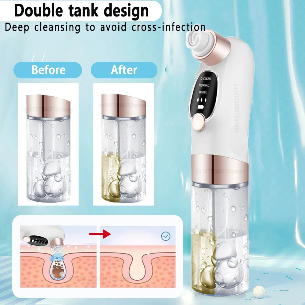 Blackhead Remover Pore Vacuum Face Cleaner Water Cycle Electric Pimple Acne Black Head Removal Rechargeable Black Dot Remover 4