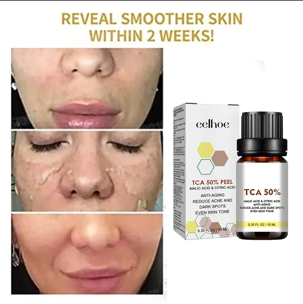 Salicylic acid facial serum Salicylic Acid Face Facial Peel Neutraliser Face Deep At Home Chemical Peel Exfoliate Refine skin care serum